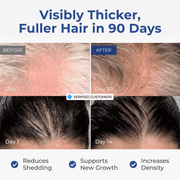 Before-and-after hair photos showing results from Neurogan Health GHK-Cu Hair and Scalp Serum.