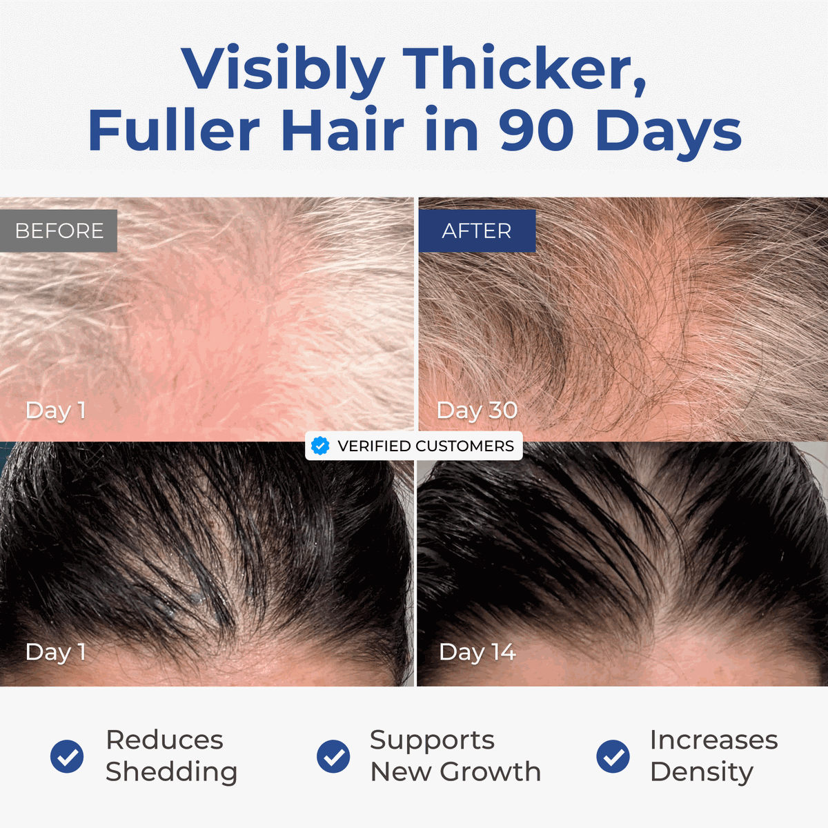 Before-and-after hair photos showing results from Neurogan Health GHK-Cu Hair and Scalp Serum.