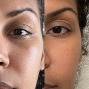 Side-by-side facial skin comparison showing the eye, cheek and under-eye area