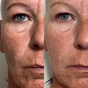 Side-by-side close-up eye and cheek comparison showing fine lines and texture