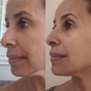 Side-by-side three-quarter facial comparison showing skin tone, texture and firmness