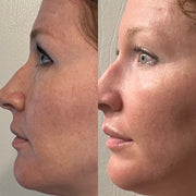 Side-by-side profile comparison showing cheek texture, tone and radiance