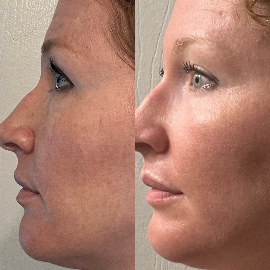 Side-by-side profile comparison showing cheek texture, tone and radiance