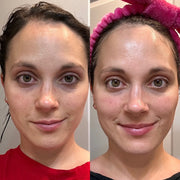 Side-by-side full-face comparison showing hydration, smoothness and radiance
