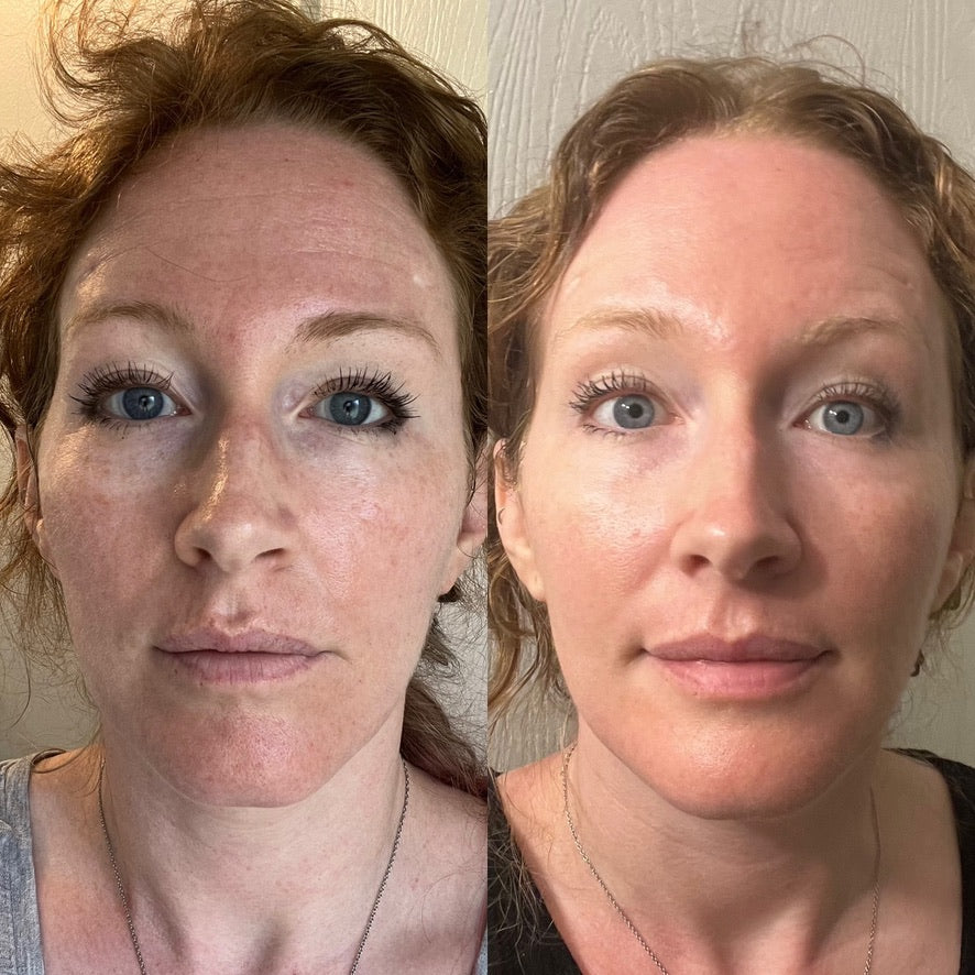 Side-by-side full-face comparison showing smoother, more radiant-looking skin