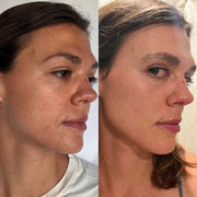 Side-by-side three-quarter facial skin comparison showing tone, texture and radiance