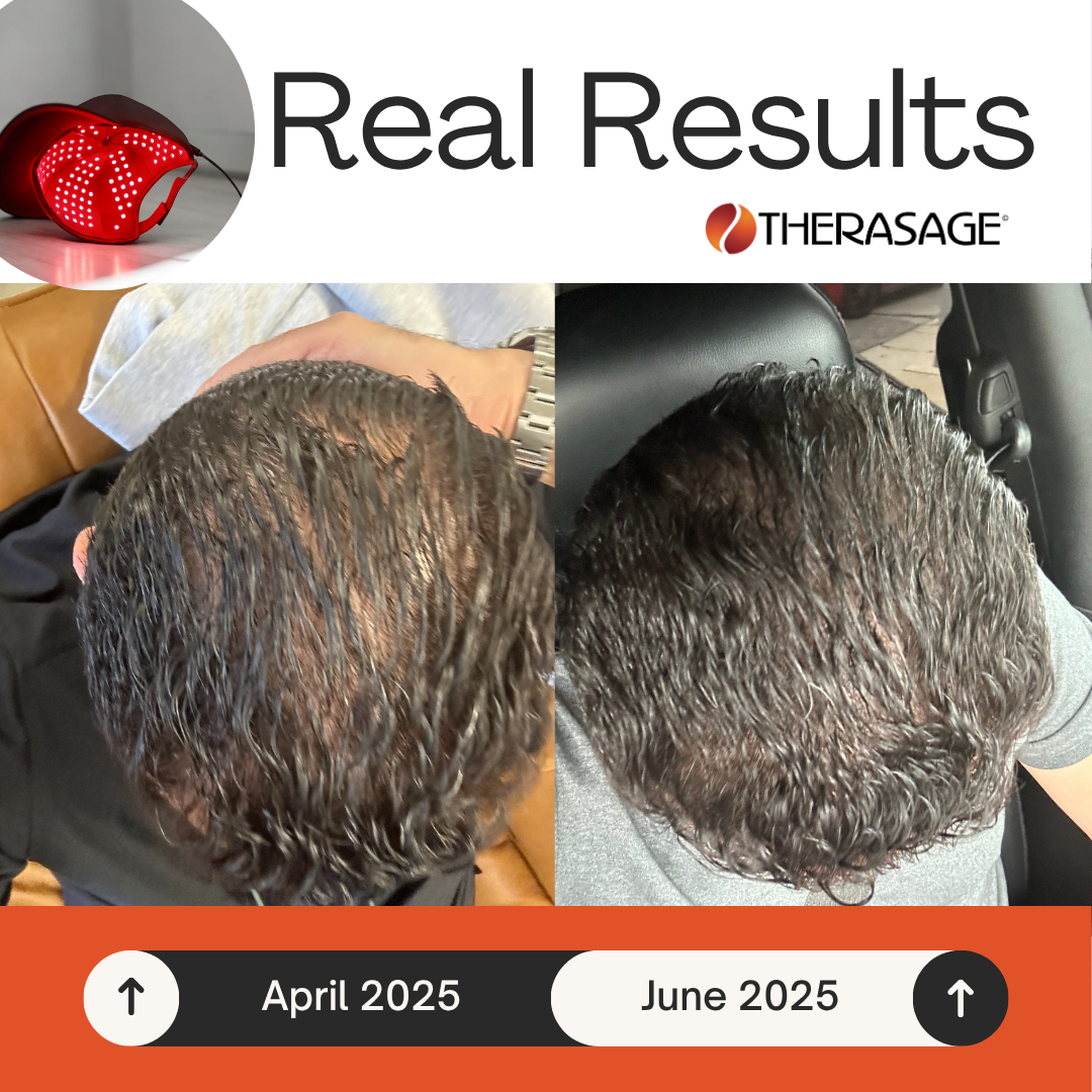 Real result of Therasage TheraCap
