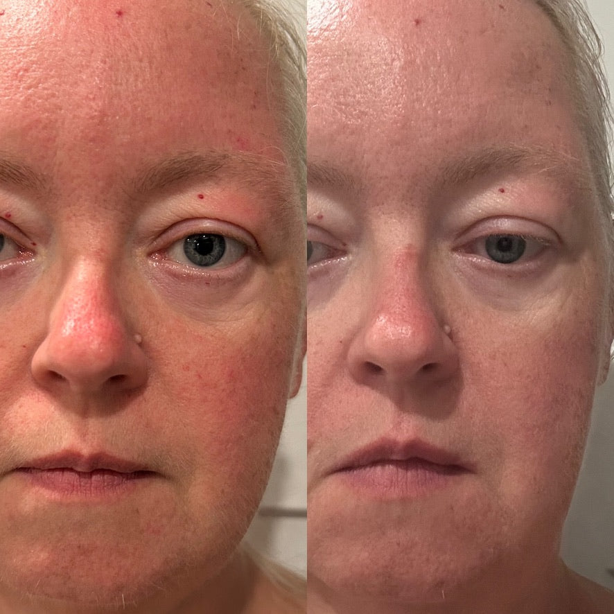 Side-by-side full-face comparison showing redness, tone and hydration