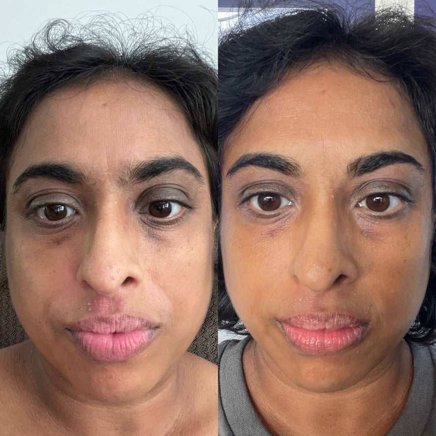 Side-by-side full-face skin comparison showing tone, hydration and radiance