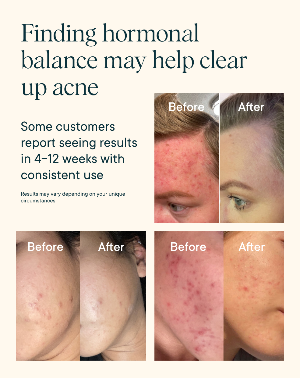Finding hormonal balance may help clear up acne - Ora Organic Hormonious: Hormonal Balance & Support Capsules