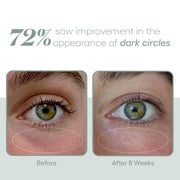 Plated Eye Exosome Serum Before and After Photo Dark Circles
