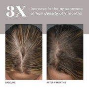 Plated Skin Science HAIR Serum - After a Month