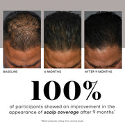 Plated Skin Science HAIR Serum - After a Month