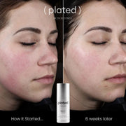 Plated Skin Science DAILY Serum - Weeks later