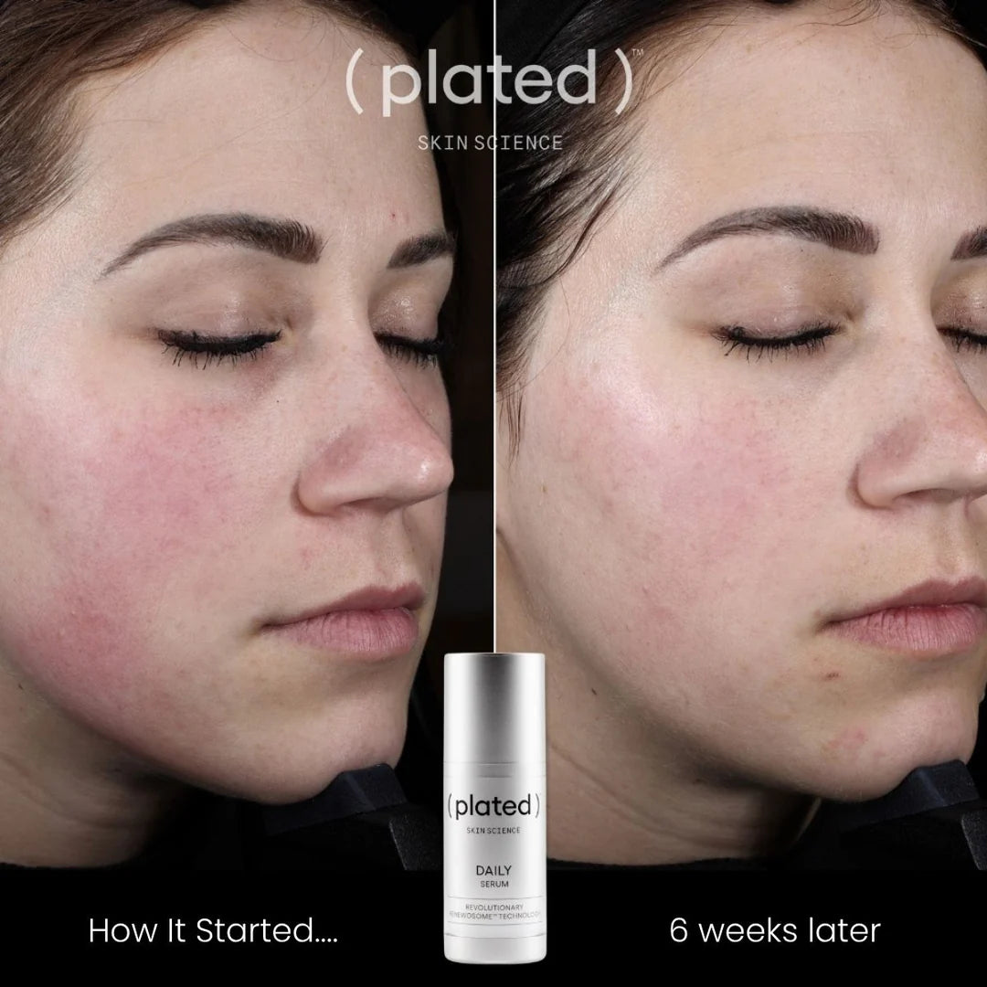 Plated Skin Science DAILY Serum - Weeks later