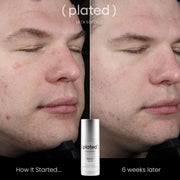 Plated Skin Science DAILY Serum - Weeks later