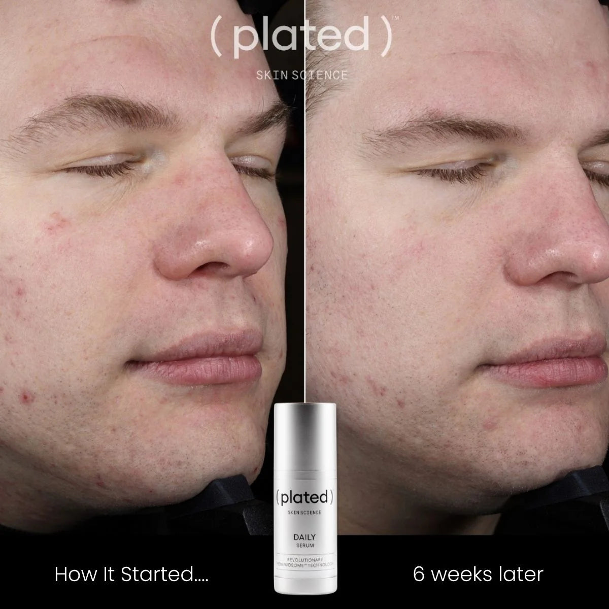 Plated Skin Science DAILY Serum - Weeks later