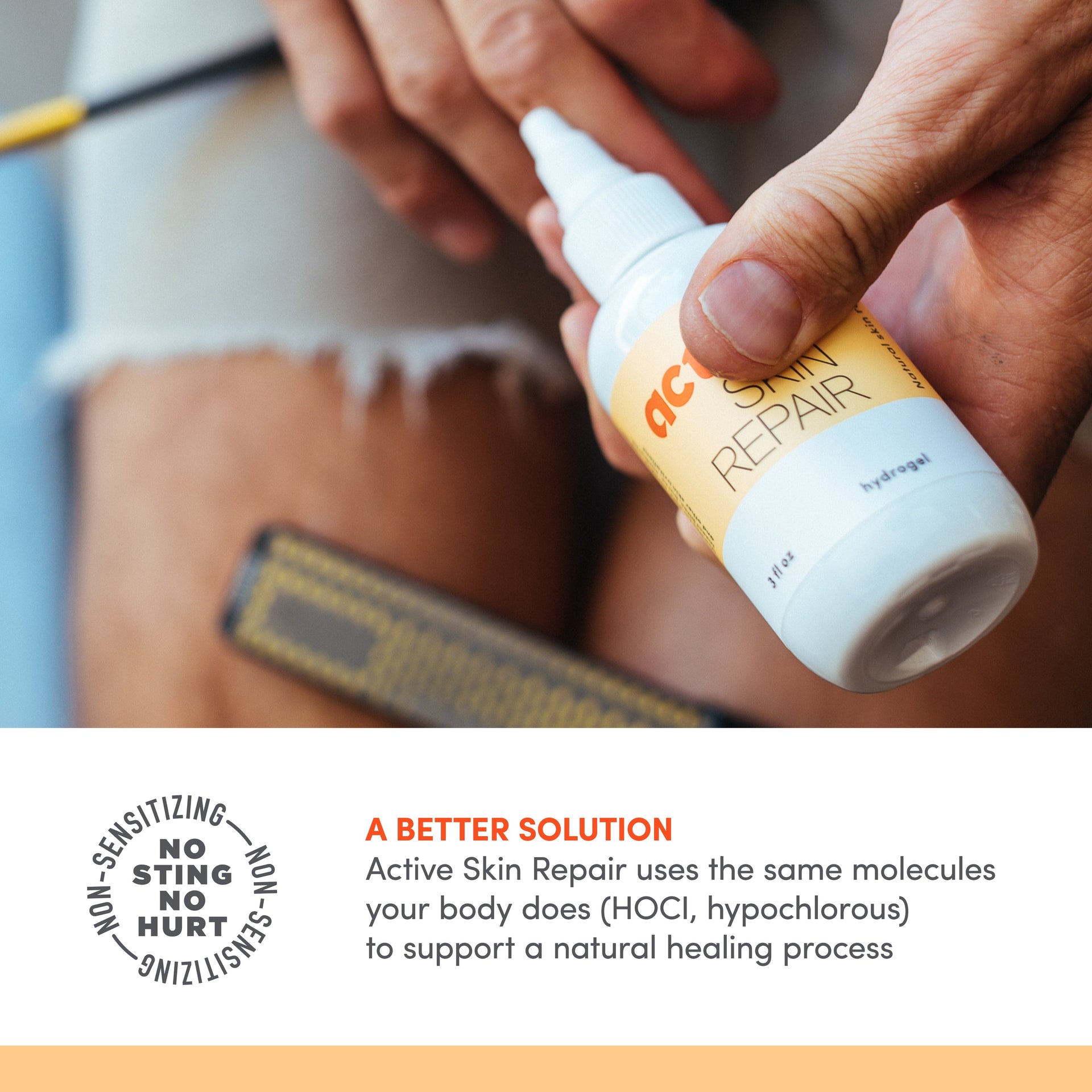 Active Skin Repair Hydrogel A Better Solution
